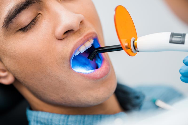 What is Laser Dentistry in Oakville - advanced laser dentistry services