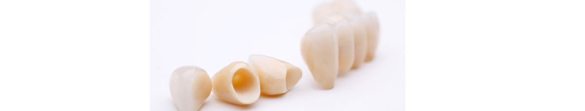 Dental Bridges Oakville - Dental Bridges