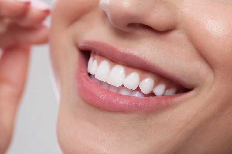 Cosmetic Treatment for Teeth at Sherwood Dental in Oakville Area