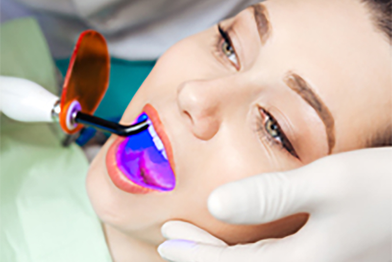 Dental Laser Treatment in Oakville Area
