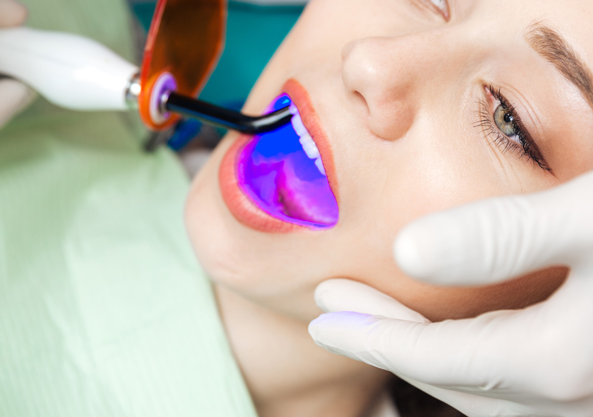 Laser Dentistry For Treatment Of Cavities In Oakville